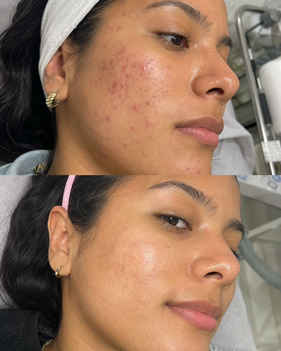 Ejemplo visual de cuidado facial