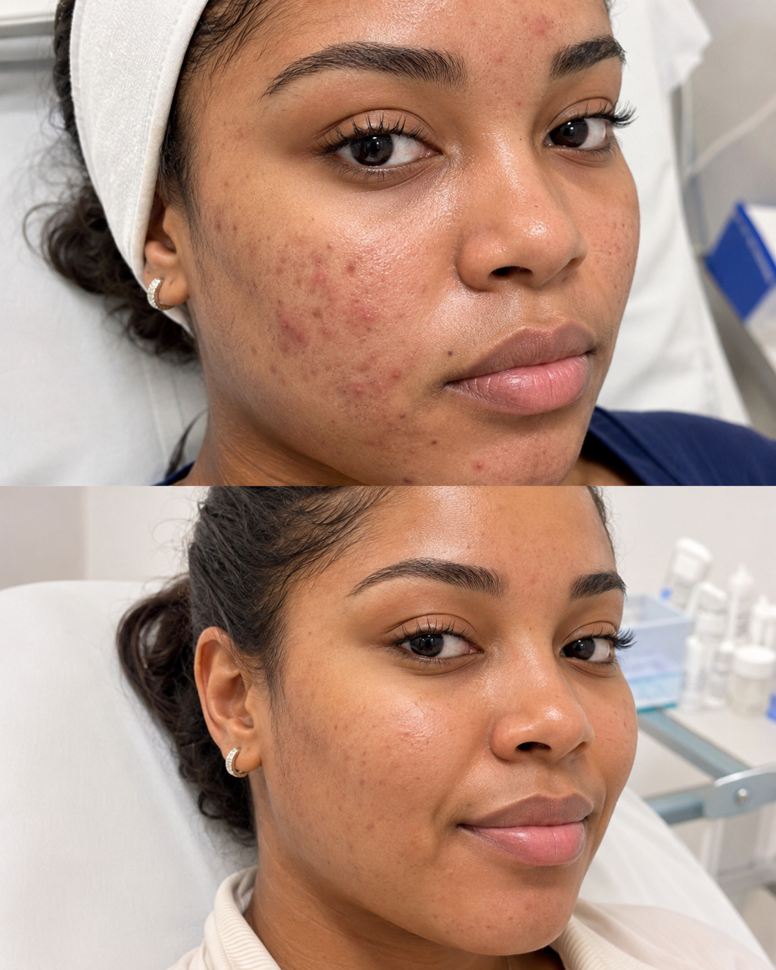 Ejemplo visual de tratamiento facial